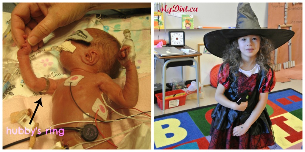 World Prematurity Day