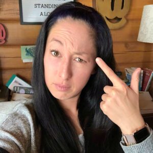 7 things I learned having facial fillers for the first time